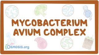 Mycobacterium avium complex  causes symptoms diagnosis treatment pathology [upl. by Ketchan]