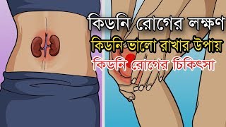 কিডনি রোগের লক্ষণ  কিডনির সমস্যা  Symptoms of kidney disease in Bangla  Rasel Bangla Health Tips [upl. by Htenek]