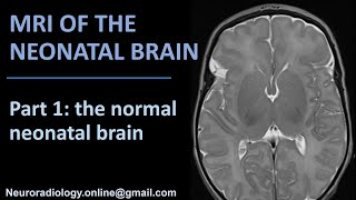 MRI of the Neonatal Brain part 1 the normal neonatal brain [upl. by Inittirb]