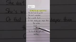 Alessia Cara  Scars To Your Beautiful Lyrics Music 2021 [upl. by Ezri]