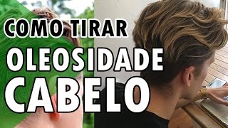 🔴 COMO TIRAR OLEOSIDADE DO CABELO MASCULINO  DICA RÁPIDA [upl. by Everett]