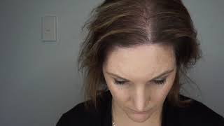 Alyssas Scalp MicroPigmentation Story  SMP for Women  Melissa Carr Cosmetic Tattooing [upl. by Hollingsworth]