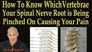 How to Know Which Vertebrae Your Spinal Nerve Root is Being Pinched On Causing Your Pain [upl. by Lucienne]