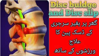 Backpain treatment by dr warda  S6  Exercises for disc pain  UrduHindi [upl. by Enela]