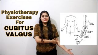 How to cure CUBITUS VALGUS  Carrying Angle Elbow क्या होता है  Cure Carrying Angle Elbow [upl. by Yulma]