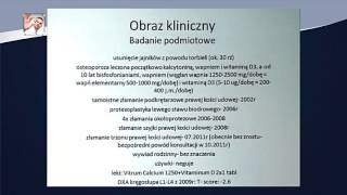 Osteoporoza kiedy leczenie może być groźniejsze od samej choroby [upl. by Ettelrahc]