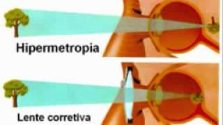 COMO FUNCIONA EL OJO HUMANO [upl. by Clawson]