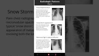 Learning radiology Part 2 shorts chest thorax [upl. by Wileen]