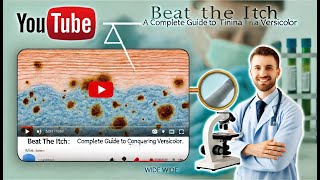 Beat the Itch A Complete Guide to Conquering Tinea Versicolor [upl. by Safko]