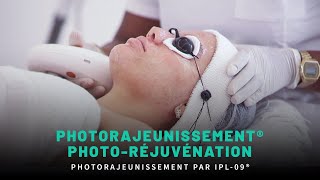 PHOTORAJEUNISSEMENT ou PHOTORÉJUVÉNATION [upl. by Acir]