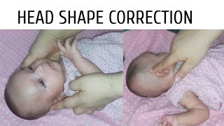 Baby Head Shape Correction  Flat Head Syndrome  Flat Head Prevention [upl. by Leese22]