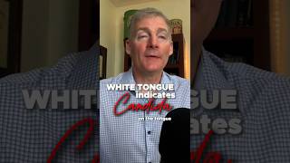 White tongue indicates Candida on the tongue [upl. by Gnidleif]