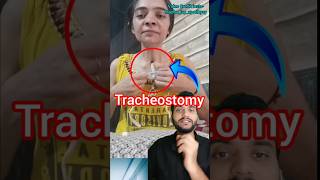 Tracheostomy shorts [upl. by Ladnar]