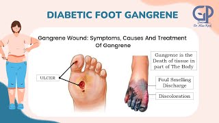 Diabetic Foot [upl. by Isle]