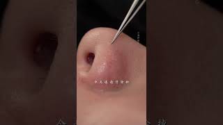 she came to quotcomfortquot her skin immersiveskincare blackheads asmr skinmanagement facialspa [upl. by Akinnor]