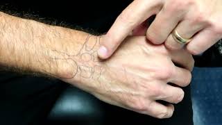 How I adjust the wrist 💥CHIROPRACTIC Secrets💥 [upl. by Yenhpad]