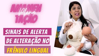 Sinais de alerta de alteração no Frênulo Lingual do bebê  AMAMENTAÇÃO PLENA [upl. by Anelagna]