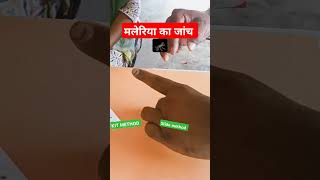 malaria test  malaria test slide method hindi [upl. by Esdnyl304]