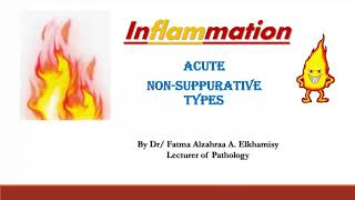 5 Acute non suppurative amp suppurative inflammation [upl. by Luamaj]