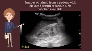 Increased renal cortical echogenicity on ultrasound is not always chronic kidney disease I POCUS [upl. by Covell]