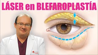 LÁSER en la BLEFATOPLASTÍA 👁️ CIRUGÍA de PÁRPADOS superiores e inferiores 👀 Dr ALBERTO CALVO QUIROZ [upl. by Kavanaugh99]