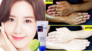 Get Fair Skin Quickly Naturally  ស្បែកសខ្ចីបាត់ស្នាមលឿន Get Clear and Fair Skin Fast [upl. by Wilser]