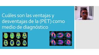 Tomografía por emisión de positrones radiologia [upl. by Adekahs768]