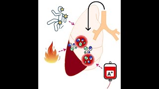 ARDS changing Definition OverviewDr Pradeep Rangappa [upl. by Rowley]