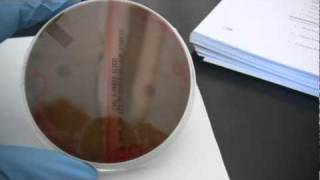 BIO 2192 UNIT 11  Strep Hemolysis Reactions on Blood Agar [upl. by Raphael]