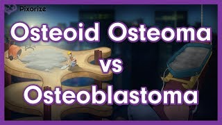 Osteoid Osteoma vs Osteoblastoma [upl. by Radloff]