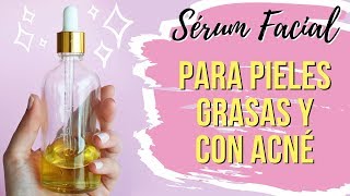 🤩 CÓMO HACER SÉRUM HIDRATANTE PARA PIEL GRASA Y CON ACNÉ 🤯 [upl. by Eevets452]