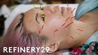 I Tried This Intense Acupuncture Facial  Beauty With Mi  Refinery29 [upl. by Manly920]