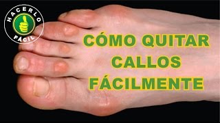 Cómo Quitar Callos de los Pies Fácilmente y Sin Dolor  Hacerlo Fácil [upl. by Kazim]