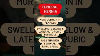 Femoral Hernia [upl. by Meyer291]