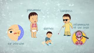 How much do you know about measles [upl. by Zildjian]