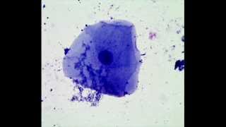 Cheek Epithelial Cells How to Prepare a Wet Mount Microscope Slide [upl. by Dedra]