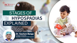 Stages Of Hypospadias  Dr Gautam Banga  SCI Hospital [upl. by Caneghem]