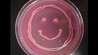 How to Interpret MacConkeys Agar Bacterial Growth Medium [upl. by Nerot]