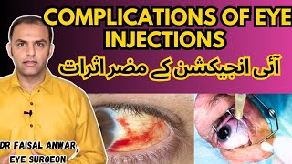 Side affects of Eye Injections  Complications of intravitreal injections eyeinjections [upl. by Anaicilef]