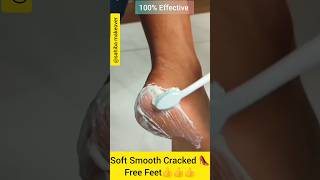 🔥Get Smooth ampSoft Feet Just 5 MntsCracked Feet Remove Homeremedy ll skincare ytshorts viralvideo [upl. by Akinajnat52]