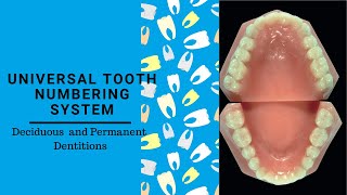 Universal tooth Notation System  Tooth Numbering System [upl. by Langdon40]