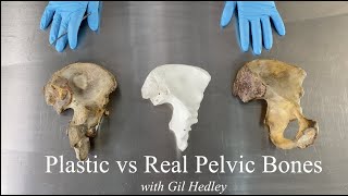 Plastic vs Real Pelvic Bones Learn Integral Anatomy with Gil Hedley [upl. by Arhas429]