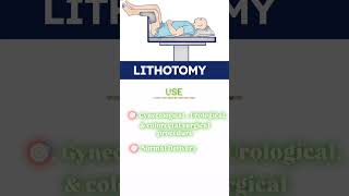 Patient positioning nursing video Important position for patients and use🎯 nursingofficerexam [upl. by Dorelle905]