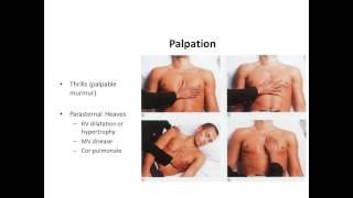 Cardiac Examination in clinical medicine [upl. by Astred]