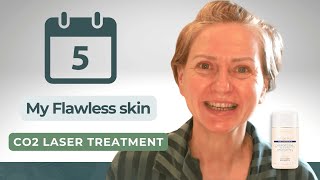 5 Days to FLAWLESS Skin with CO2 Laser Treatment [upl. by Assilav833]