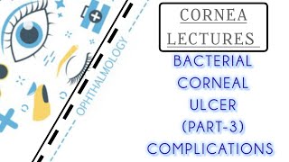 CORNEA LECTURE 5 COMPLICATIONS OF CORNEAL ULCER [upl. by Ruffina889]