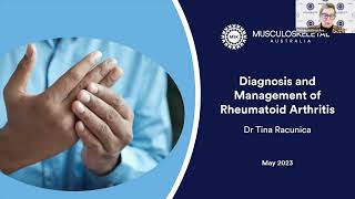 Diagnosis and management of Rheumatoid Arthritis [upl. by Akciret]