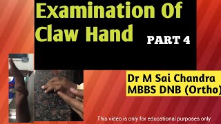 Examination Of Claw Hand [upl. by Wilcox51]