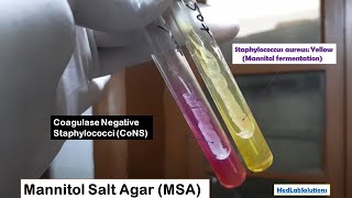 Staphylococcus aureus and Coagulase Negative Staphylococci CoNS growth on Mannitol Salt Agar MSA [upl. by Boycie363]