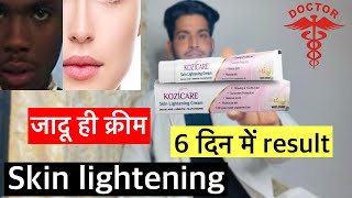 Kozicare cream  kozicare cream review  kozicare cream side effects  Kozicare cream how to use [upl. by Aihppa231]